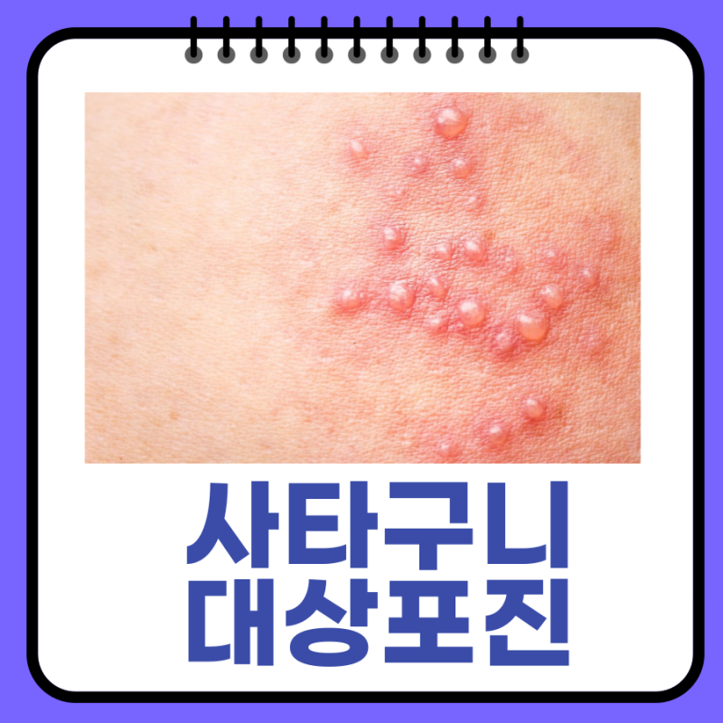 사타구니 대상포진 증상과 원인 사타구니 포진 차이점