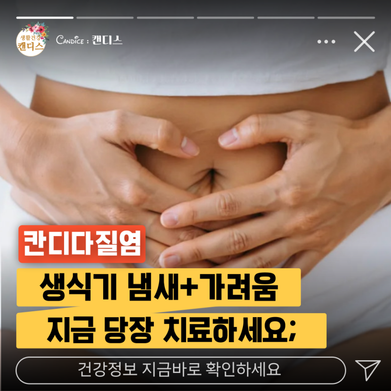 칸디다질염 완치 확실한가요? 증상사라졌다고 방심하면 이렇게됩니다