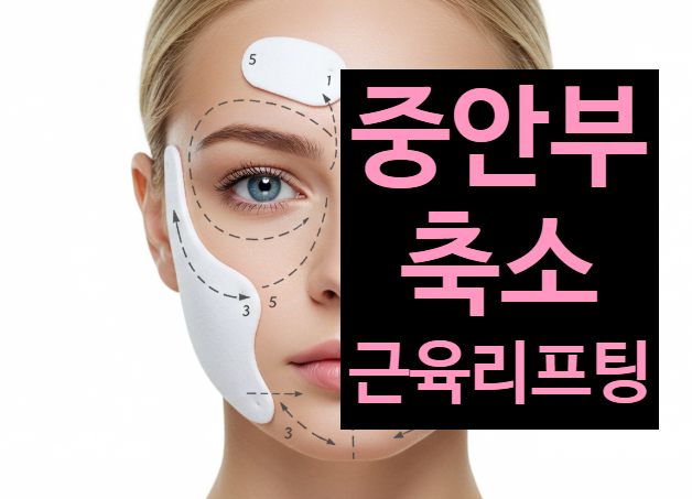  이브타이탄 중안부축소 근육리프팅 안산아르네의원에서 알려드려요