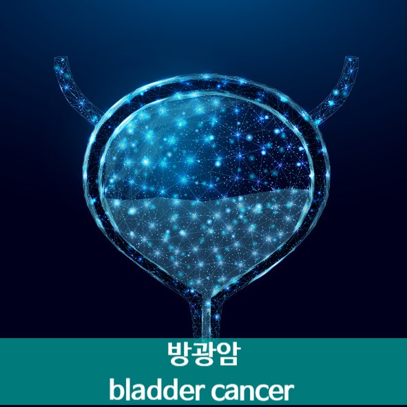 방광암초기증상, 남녀가 다르다? 남자 방광암 증상 vs 여자 방광암 증상