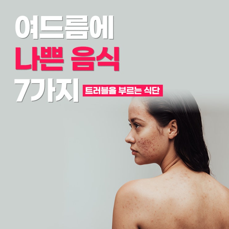 [피부] 여드름에 나쁜 음식 7가지 - 트러블을 부르는 식단