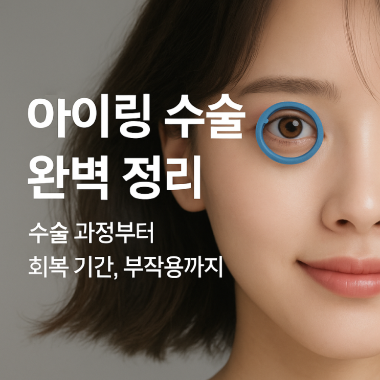  아이링 수술 완벽 정리: 수술 과정부터 회복 기간,부작용까지