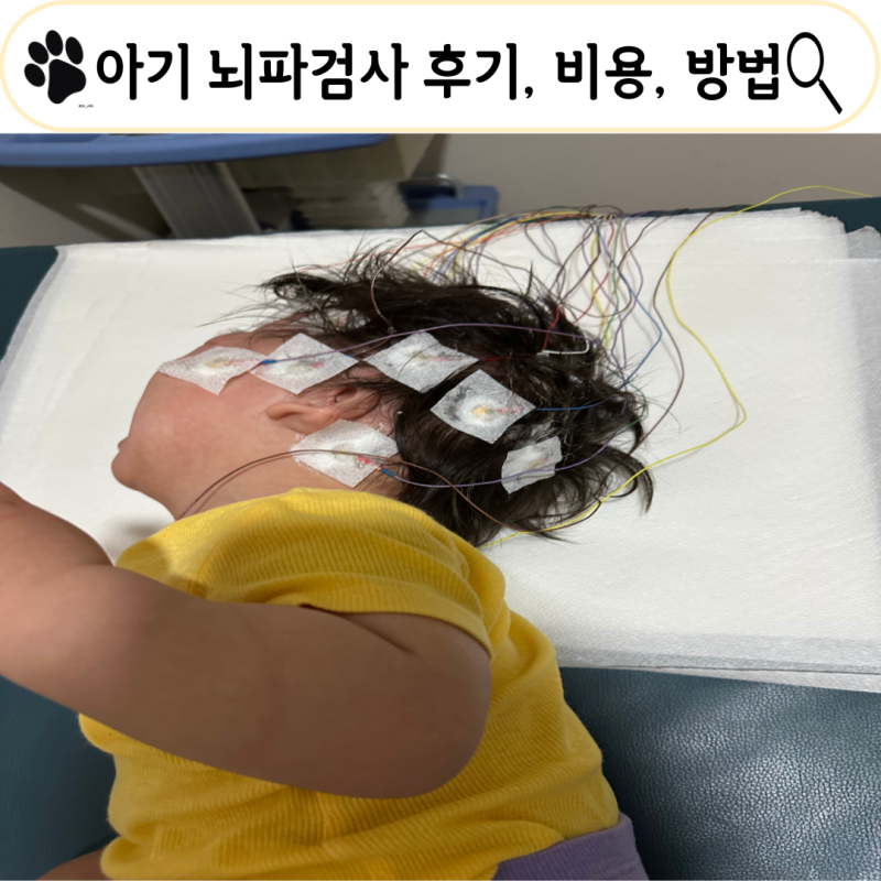 아기 뇌파검사 후기, 세균성 뇌수막염 후 뇌손상, 항경련제 줄이고 희망을 보다