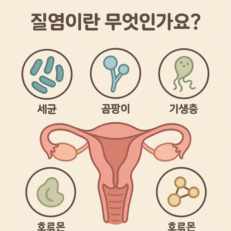 질염 자연치유 칸디다질염 세균성 질염 증상 치료 총정리