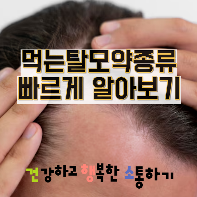  먹는탈모약종류 빠르게 알아보기
