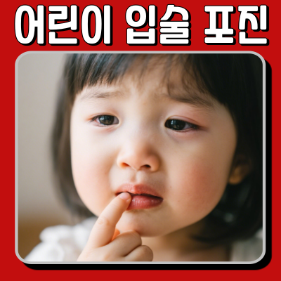 어린이입술포진 초기증상과 대처법 정리