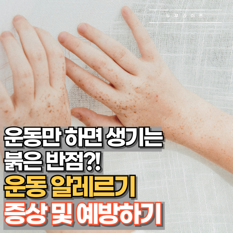  운동만 하면 생기는 붉은 반점?! 운동 알레르기 증상 및 예방하기