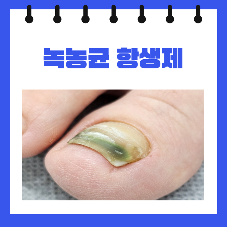  녹농균 항생제 약 치료기간 원인 증상 다제내성녹농균 총정리