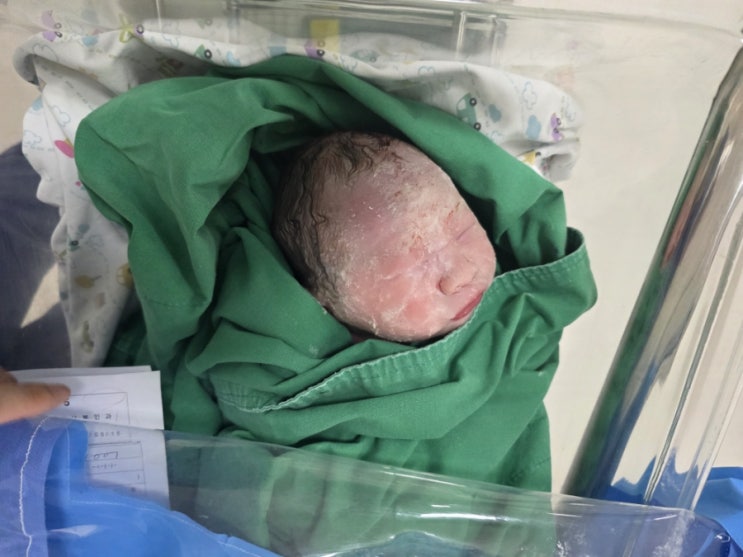 갓 태어난 아기 피부의 신비로운 선물, '태지'에 대해 알아봐요!