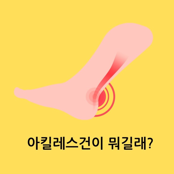 아킬레스건 부음 아킬레스건염 점액낭염 파열 대처법