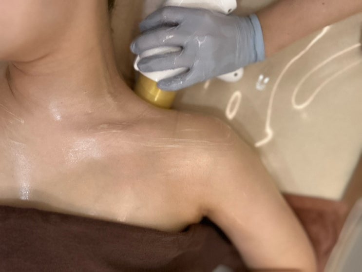  한달만에 민소매 가능?! 팔뚝살 없애주는 앰플 + 에스테틱 시술 리얼 후기 공개