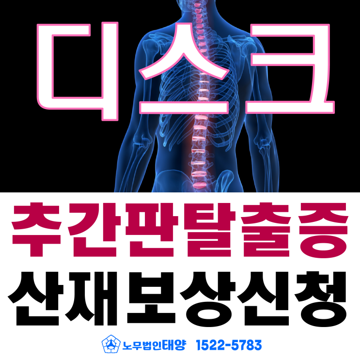  [목/허리디스크] 추간판탈출증 수술비용 산재 보상 신청가능할까?