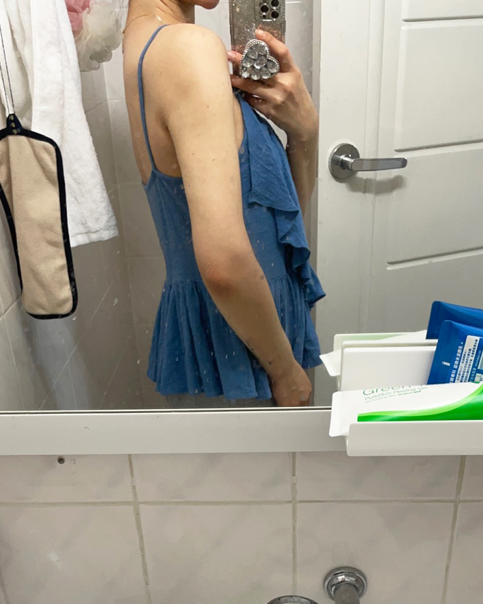  동성로팔뚝다이어트 지방흡입 두달차 변화