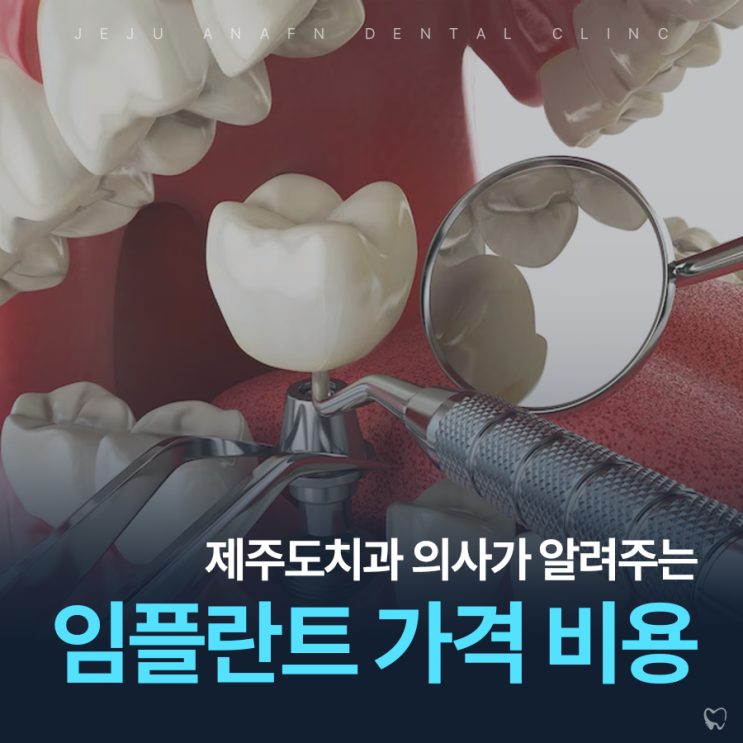  제주도치과 임플란트 가격 비용 중요하다면 클릭