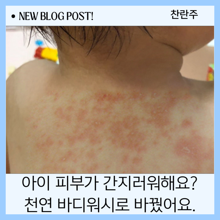  천연 바디워시 저자극 제품만 7개 바꿔본 엄마의 결론