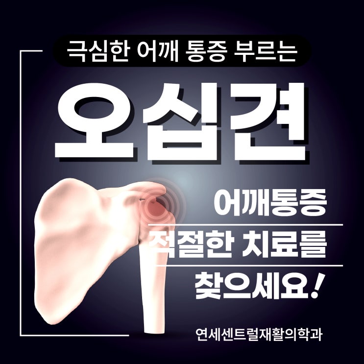  충무로어깨통증, 직장인의 흔한 고통? 3040 오십견