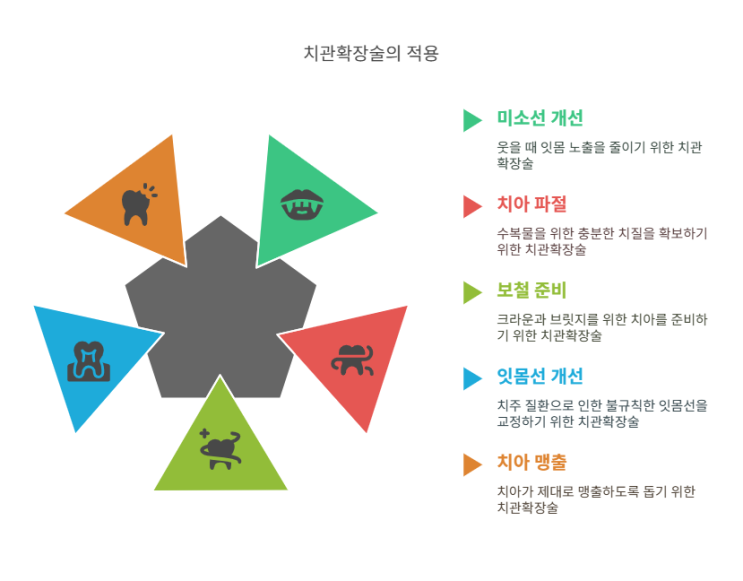  크라운 랭스닝(치관 확장술)