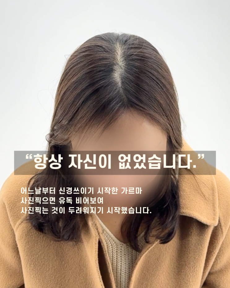  대전두피문신가격, 저렴한 가격보다 더 중요한 것