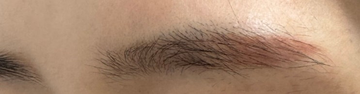  대전 눈썹 문신, 눈썹 문신 잔흔 제거 잘하는 곳 대전 도안동 눈썹 반영구 애프터글로우.