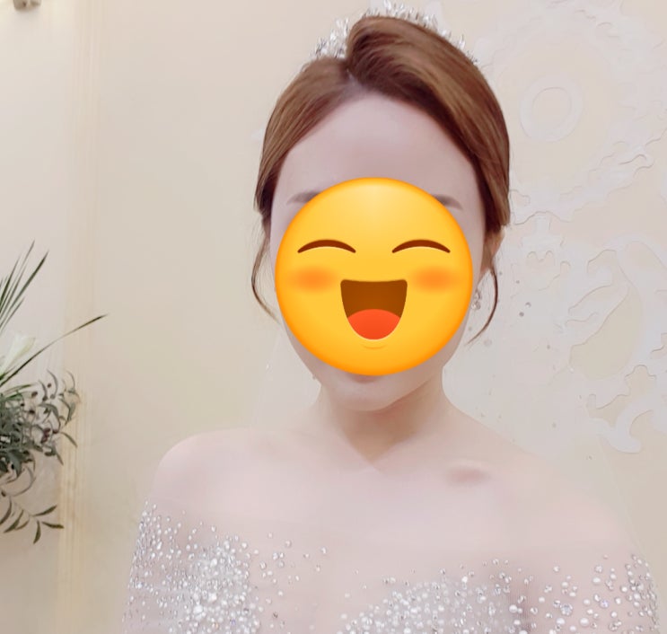  인천 예비신부관리 헤어라인 두피페인팅 본식 전 추천 시기 정보