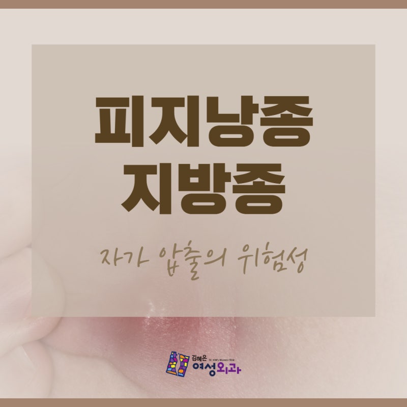 천안 피부양성종양 피지낭종 지방종 자가 압출의 위험성