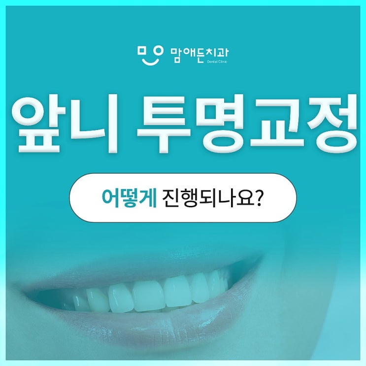  앞니 투명교정 적용 대상 및 특징 확인하기