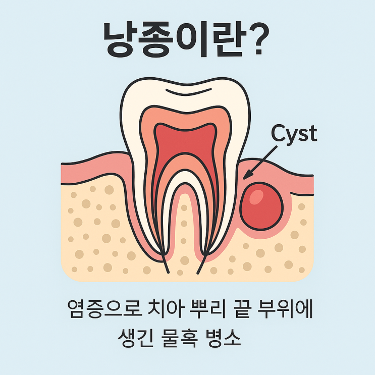  낭종, 방치하면 뼈까지 녹습니다. 정확한 진단과 수술 사례 소개