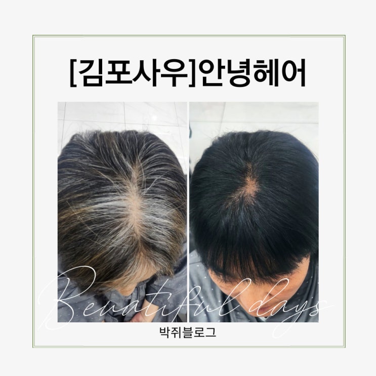  김포미용실 사우동미용실 안녕헤어에서 새치염색 시술받은 솔직후기