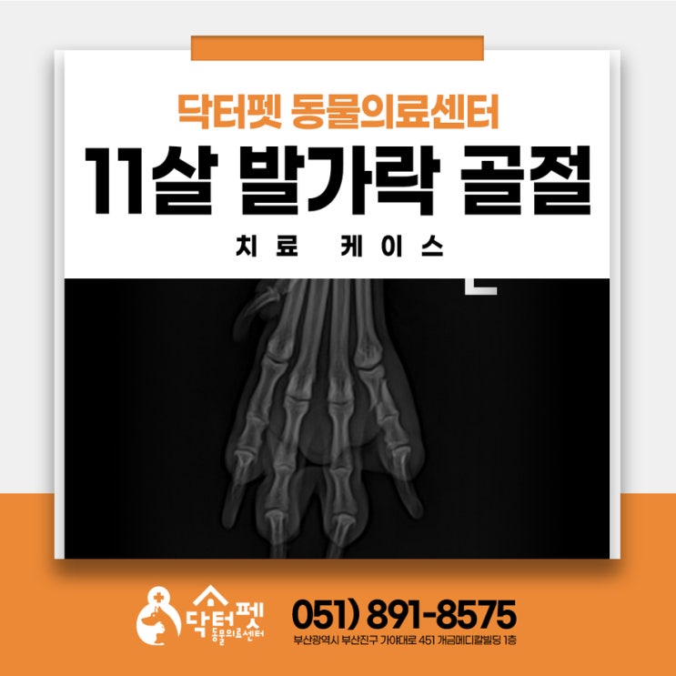  11살 할아버지 비숑 발가락 골절 수술 없이 깁스 교정으로 7주 회복 부산동물병원 강아지