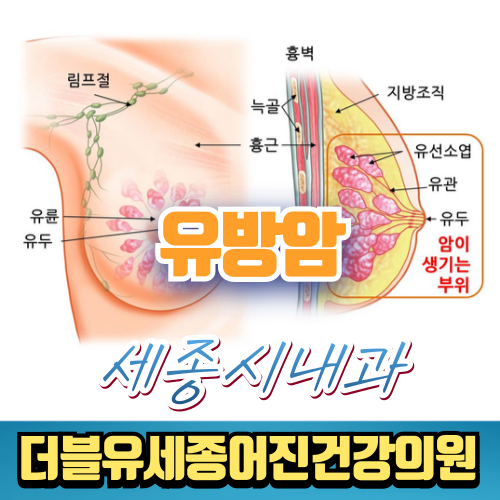 세종시 유방암, 조기검진이 생명을 지킵니다 – 세종시 유방암검진 병원 안내