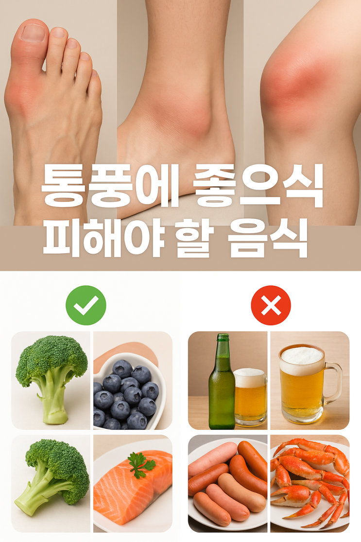  통풍에 좋은 음식과 피해야 할 음식,요산 낮추는 식단 가이드