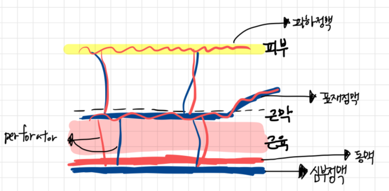 투석혈관?