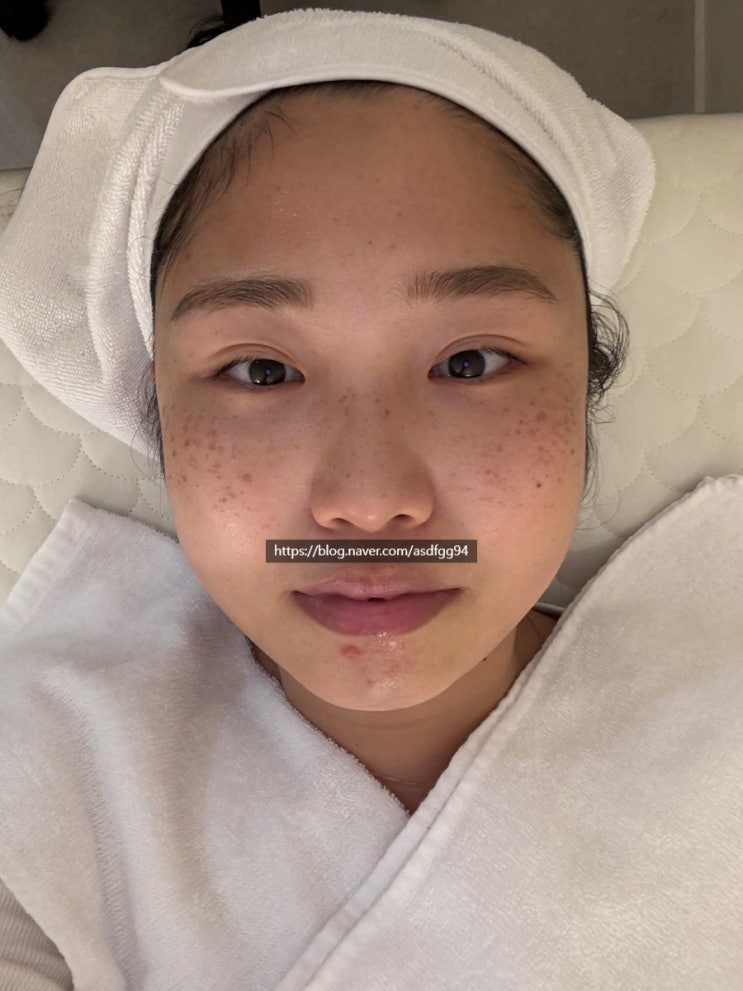  부평 피부관리샵 데자뷰메디스킨 인천점 커플피부관리로 추천