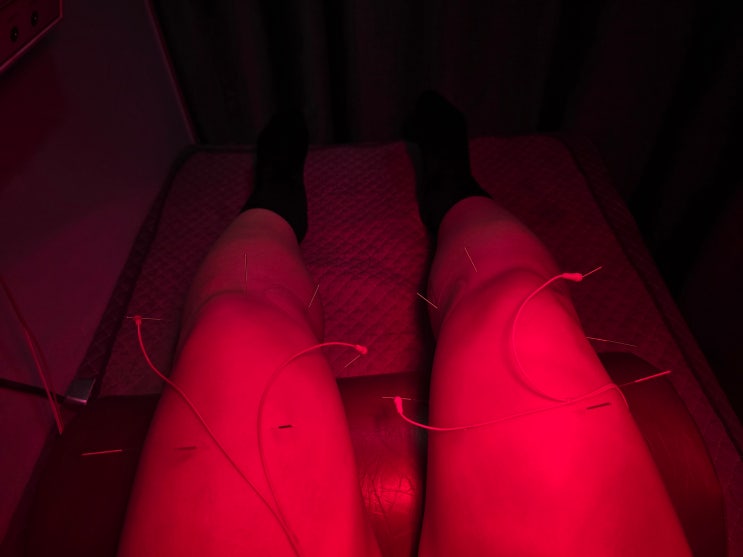  #21 박살난 무릎 다시 붙이느라 한주가 다 갔다네