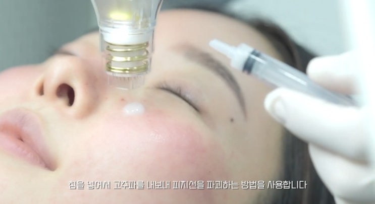 해운대 포텐자, 무턱대고 받지 마세요 해운대 포텐자, 무턱대고 받지 마세요