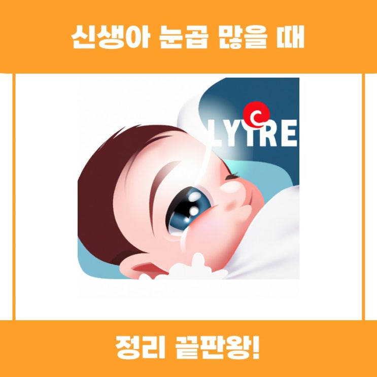  신생아 눈곱 많을 때 이유와 대처법 알아볼까요