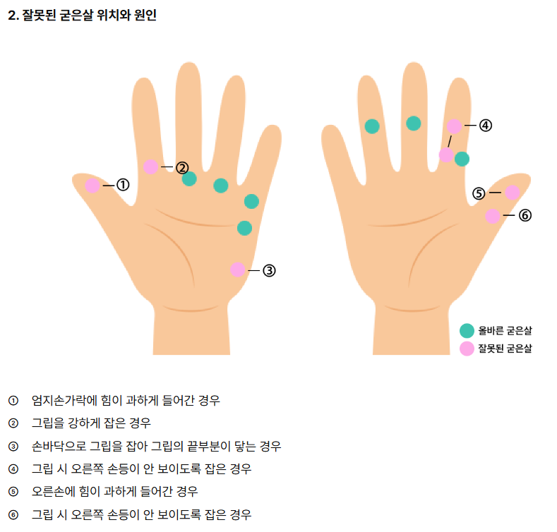 골프 그립과 굳은살 위치로 보는 골프 스윙을 올바르게 하고있는지 진단법