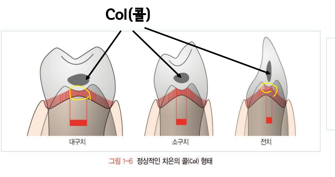[치주학] 치주조직 총정리 | 치은 구성종류 구조 변연치은 | 치주인대 샤피섬유 | 백악질 | 상아질 | 치조골 | 연령에 따른 ...