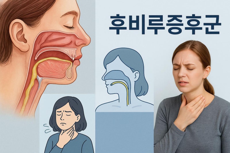 후비루증후군 증상 원인 치료, 한의원 생활관리까지 정리