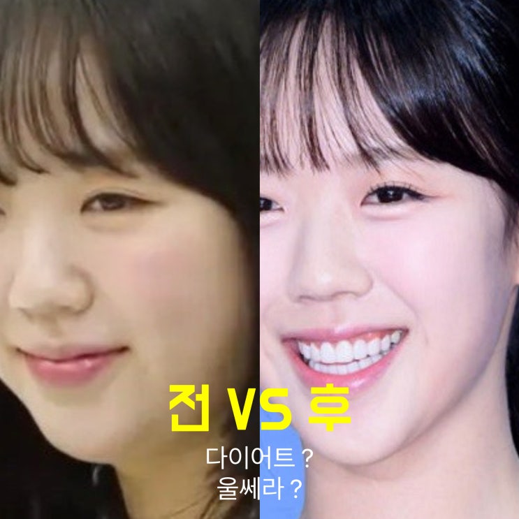  연예인 지예은 다이어트 성공 & 울쎄라 효과? 투턱 실종, 턱선 날렵해진 비결은?