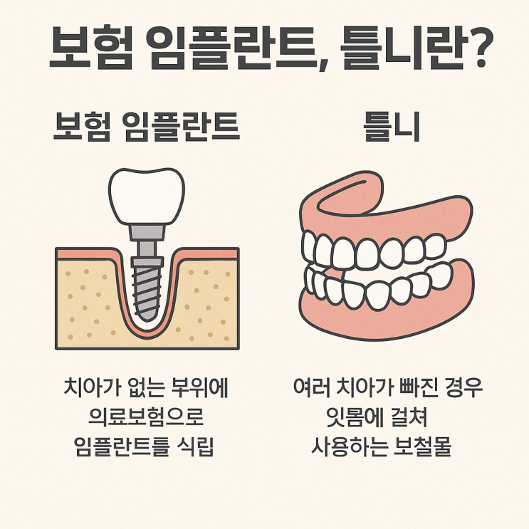  "틀니가 자꾸 빠진다면? 보험 임플란트 틀니로 해결한 실제 사례"