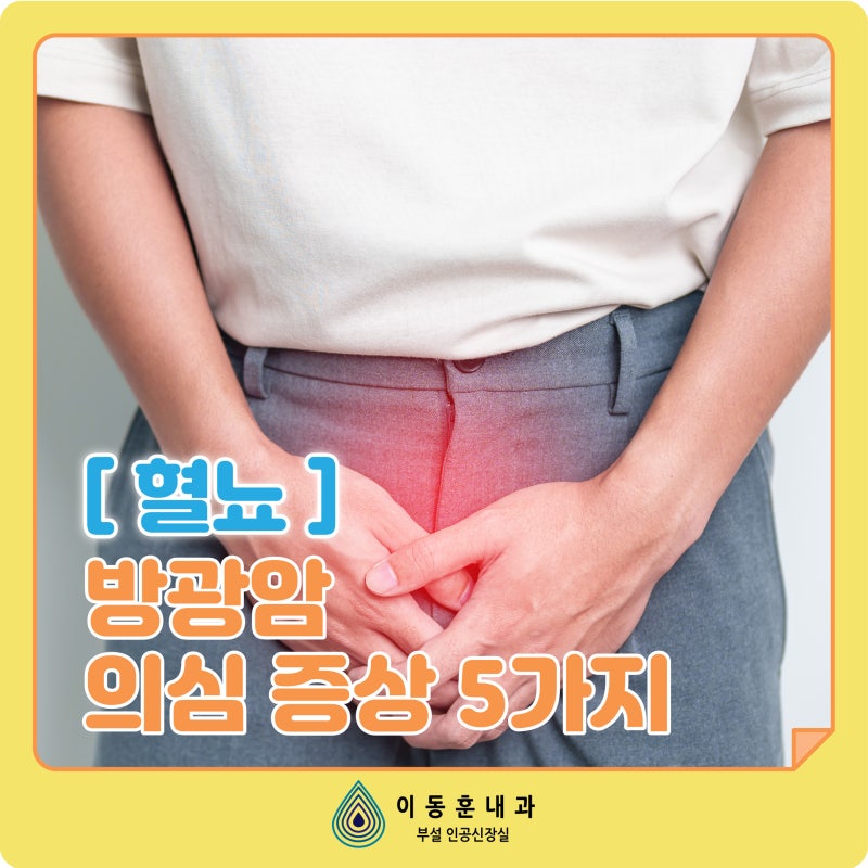 [혈뇨] 방광암 의심 증상 5가지