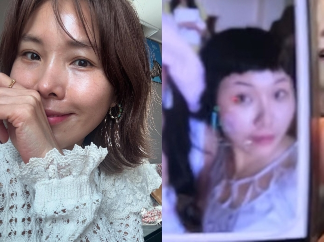  신봉선, 11kg 감량+피부과 시술 효과에 감탄 “예뻐졌다고 하는 이유 알겠더라”