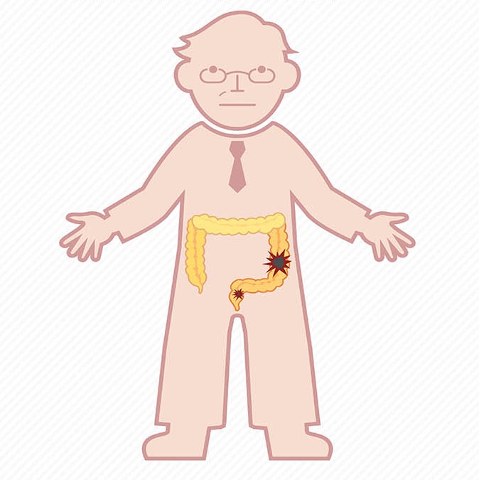 [대장암] 한국인에게 흔한 암 인포그래픽