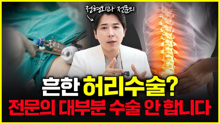  허리디스크 수술? 정형외과 전문의 95%는 수술을 권하지 않습니다