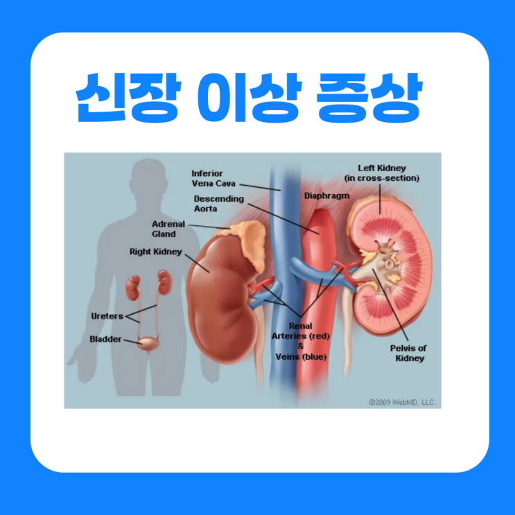  신장 이상 증상 소변 어지러움 구토 가려움증 부종 검사