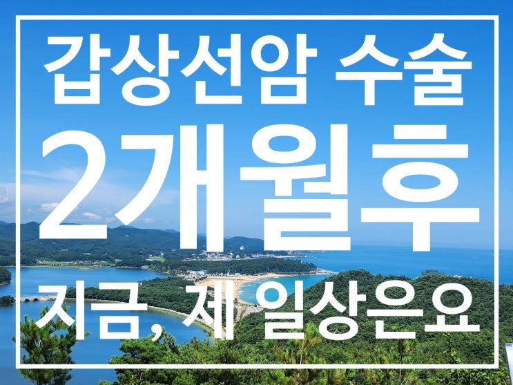  갑상선암 수술 2개월 후, 일상 복귀와 건강 관리 노하우