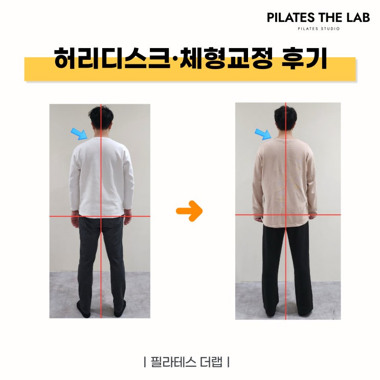  목동필라테스, 허리디스크 체형교정 사례로 보는 운동 효과