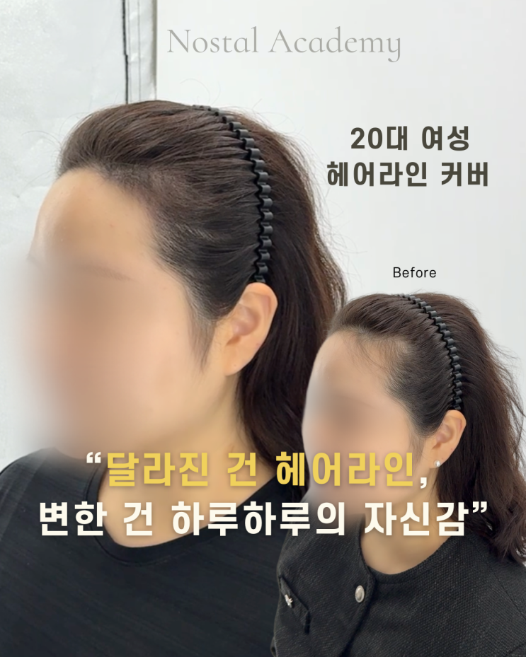  대전헤어라인두피문신, 자신감을 채우다