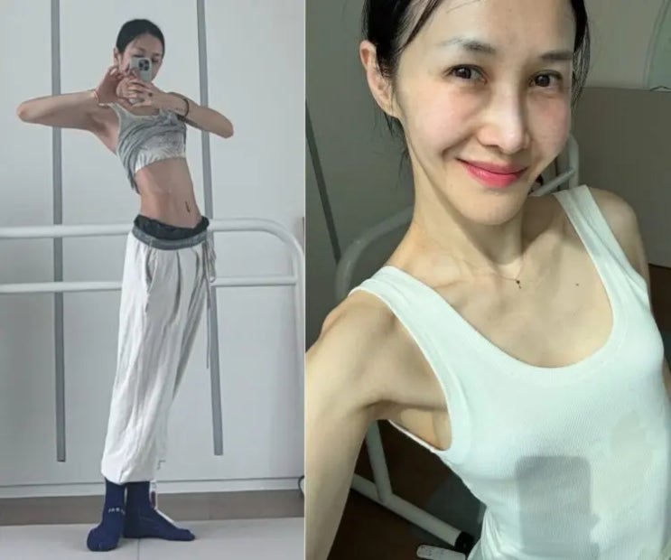 윤혜진 41kg 극세사 몸매 비결? 장요근 스트레칭 & 사이드... 